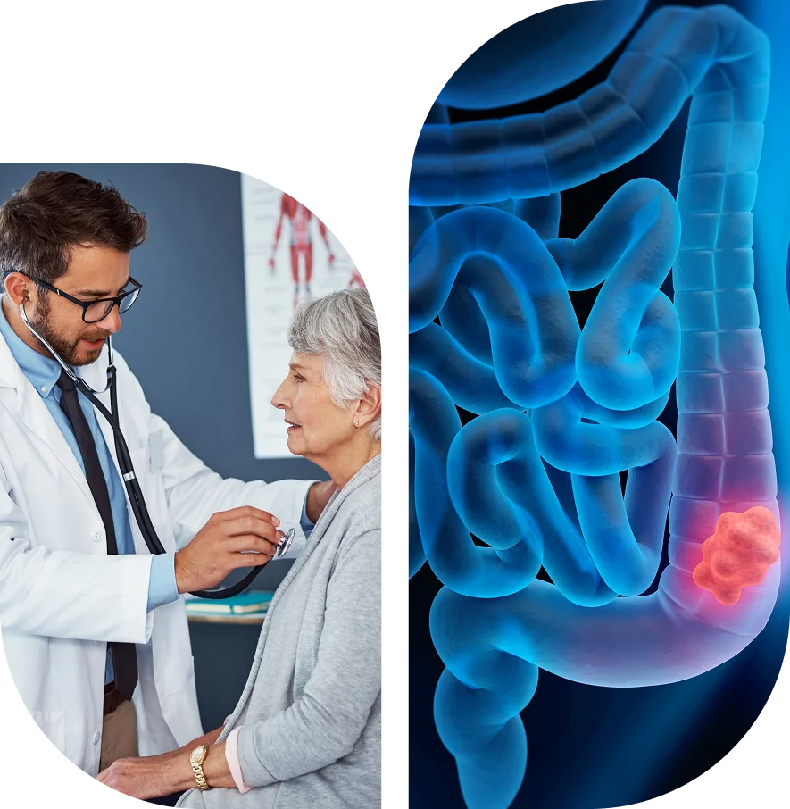 Group 1321316525 (1) (1) A doctor examines an older woman; next to them is a digital illustration of a colon with a highlighted tumor.